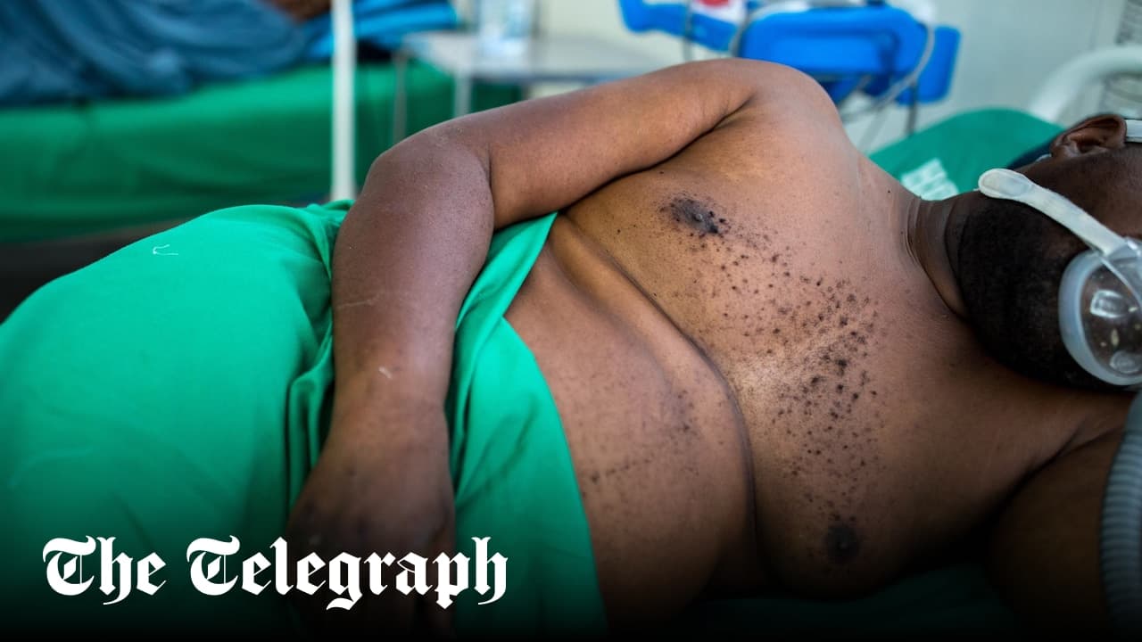 'There's a Big Difference Between the First Variant and This One': Mozambique's Covid Crisis